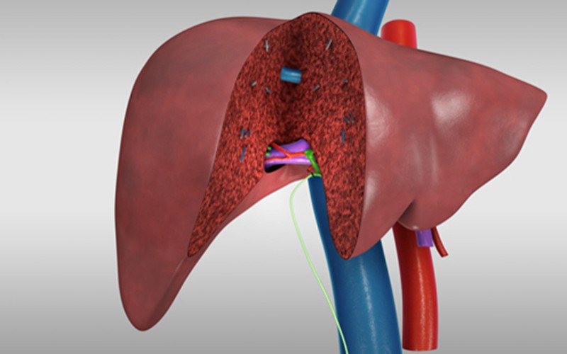 Liver Transplantation in Bannerghatta